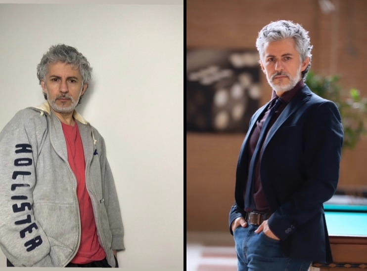 Antes e depois Charles Veiyga